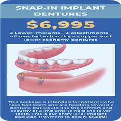 Dental Implants » Lignum Dental